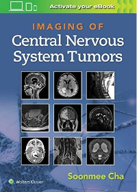 (eBook EPUB)Imaging of Central Nervous System Tumors by Soonme Cha