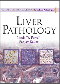 Liver Pathology (Consultant Pathology Book 4) 1st Edition