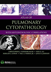 (eBook PDF)Atlas of Pulmonary Cytopathology 1st Edition