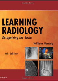 (eBook PDF)Learning Radiology: Recognizing the Basics 4th Edition by William Herring MD FACR  Elsevier; 4th Edition (February 2, 2019)