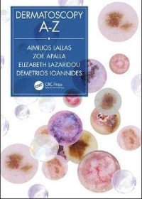 (eBook PDF)Dermatoscopy A-Z 1st Edition by Aimilios Lallas , Zoe Apalla , Elizabeth Lazaridou , Dimitrios Ioannides  