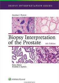 (eBook PDF)Biopsy Interpretation of the Prostate 6th Edition by Jonathan I. Epstein  Wolters Kluwer Health; 6th edition edition (21 Jan. 2020)