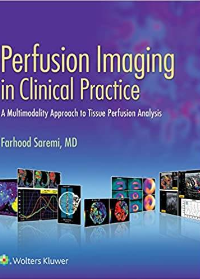 (eBook PDF)Perfusion Imaging in Clinical Practice by Farhood Saremi  LWW; First edition (July 14, 2015)