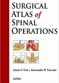 (eBook PDF)Surgical Atlas of Spinal Operations by Jason C. Eck , Alexander R. Vaccaro  Jaypee Brothers Medical Pub; 1 edition (April 1, 2013)