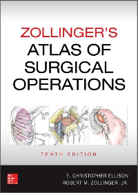 (eBook PDF)Zollinger s Atlas of Surgical Operations, Tenth Edition by Robert M. Zollinger Jr., E. Christopher Ellison