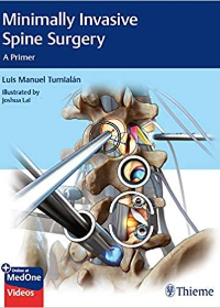 (eBook PDF)Minimally Invasive Spine Surgery: A Primer 1st Edition by Luis Manuel Tumialan  Thieme; 1st Edition (September 14, 2020)