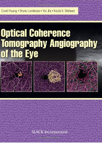 (eBook PDF)Optical Coherencre Tomography Angiography of the Eye by David Huang , Bruno Lumbroso , Yali Jia , Nadia K. Waheed  SLACK Incorporated; 1 edition (30 Aug. 2017)