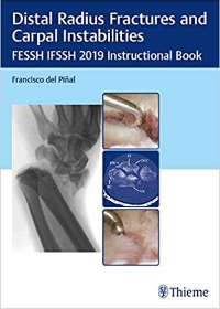 (eBook PDF)Distal Radius Fractures and Carpal Instabilities: FESSH IFSSH 2019 Instructional Book 1st Edition by Francisco del Pinal  Thieme; 1st Edition (June 24, 2019)