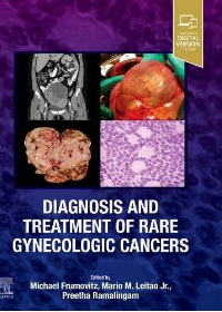 (eBook PDF)Diagnosis and Treatment of Rare Gynecologic Cancers by Michael Frumovitz MD  PhD,Mario Leitao MD,Preetha Ramalingam