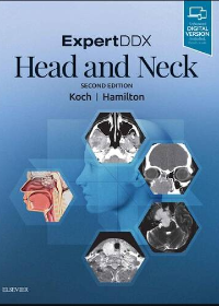 (eBook PDF)ExpertDDX: Head and Neck 2nd Edition by Bernadette L. Koch,Bronwyn E. Hamilton