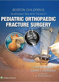 (eBook PDF)Boston Children’s Illustrated Tips and Tricks in Pediatric Orthopaedic Fracture Surgery by Peter M Waters MD , Daniel Hedequist  Wolters Kluwer Health; 1 edition (28 Nov. 2019)