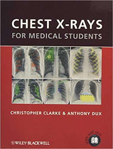 (eBook PDF)Chest X-rays for Medical Students by Christopher Clarke , Anthony Dux 