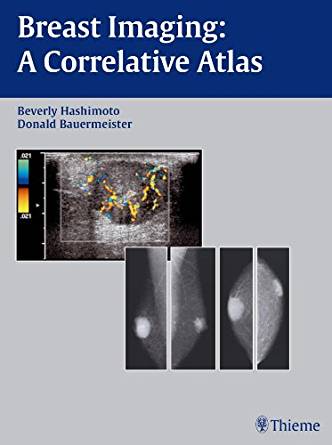 (eBook PDF)Breast Imaging - A Correlative Atlas by Beverly Hashimoto , Donald Bauermeister 