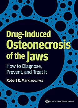 (eBook PDF)Drug-Induced Osteonecrosis of the Jaws: How to Diagnose, Prevent, and Treat It by Robert E. Marx 