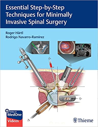 (eBook PDF)Essential Step-by-Step Techniques for Minimally Invasive Spinal Surgery by Roger Hartl 