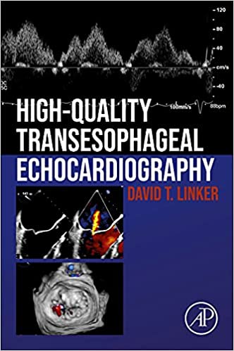 (eBook PDF)High-Quality Transesophageal Echocardiography by David T. Linker