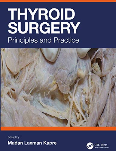 (eBook PDF)Thyroid Surgery: Principles and Practice 1st Edition