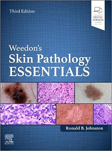 (eBook PDF)Weedon s Skin Pathology Essentials 3rd Edition by Ronald Johnston MD 