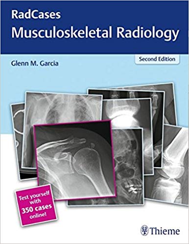 (eBook PDF)RadCases Musculoskeletal Radiology, 2nd Edition + 1st Edition by Glenn M. Garcia 