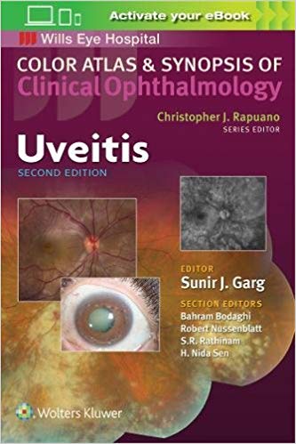 (eBook PDF)Uveitis (Color Atlas and Synopsis of Clinical Ophthalmology)，2nd Edition by Sunir J. Garg 