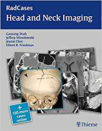 (eBook PDF)Head and Neck Imaging  by Gaurang Shah , Jeffrey Robert Wesolowski , Jeanie Choi , Elliott Friedman 