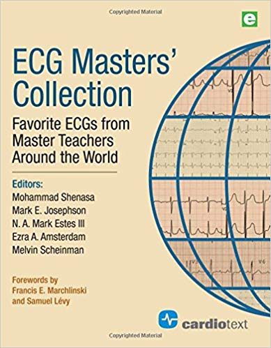 (eBook PDF)ECG Masters  Collection: Favorite ECGs from Master Teachers Around the World Volume 2 by Mohammad Shenasa , Mark E.Josephson , N.A. Mark Estes III , Ezra Amsterdam , Melvin Scheinman , Mark E. Josephson , N.A. Mark Estes 