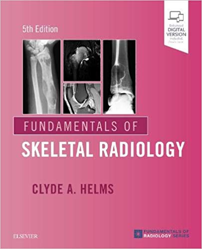 (eBook PDF)Fundamentals of Skeletal Radiology 5th Edition by Clyde A. Helms MD 