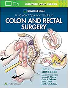 (eBook PDF)Cleveland Clinic Illustrated Tips and Tricks in Colon and Rectal Surgery by Scott Steele 