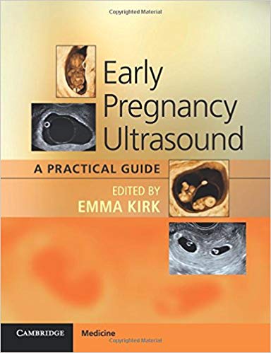 (eBook PDF)Early Pregnancy Ultrasound - A Practical Guide by Emma Kirk 