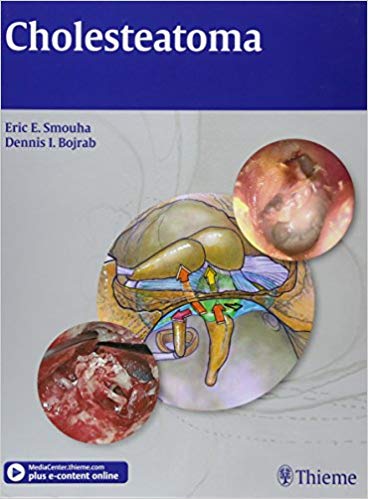 (eBook PDF)Cholesteatoma  by Eric E. Smouha , Dennis I. Bojrab 