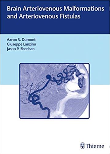 (eBook PDF)Brain Arteriovenous Malformations and Arteriovenous Fistulas by Aaron S. Dumont , Giuseppe Lanzino , Jason P Sheehan 