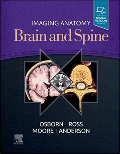 (eBook PDF)Imaging Anatomy Brain and Spine, E-Book by Anne G. Osborn MD FACR , Karen L. Salzman MD , Jeffrey S. Anderson MD PhD , Arthur W. Toga, Meng Law MD , Jeffrey Ross MD , Kevin R. Moore MD 