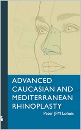 (eBook PDF)Advanced Caucasian and Mediterranean Rhinoplasty by P.J.F.M. Lohuis 