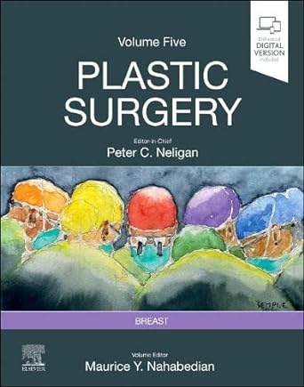 (eBook PDF)Plastic Surgery: Volume 5: Breast (Plastic Surgery, 5) 5th Edition by Maurice Y Nahabedian MD FACS , Peter C. Neligan MB FRCS(I) FRCSC FACS 