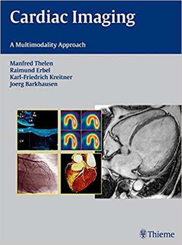 (eBook PDF)Cardiac Imaging - A Multimodality Approach by Manfred Thelen , Raimund Erbel , Karl-Friedrich Kreitner , Joerg Barkhausen , Jörg Barkhausen 