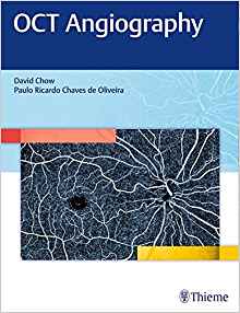 (eBook PDF)OCT Angiography by David Chow 