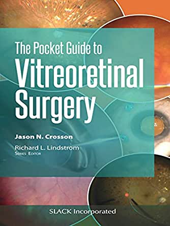 (eBook PDF)The Pocket Guide to Vitreoretinal Surgery by Jason N. Crosson 