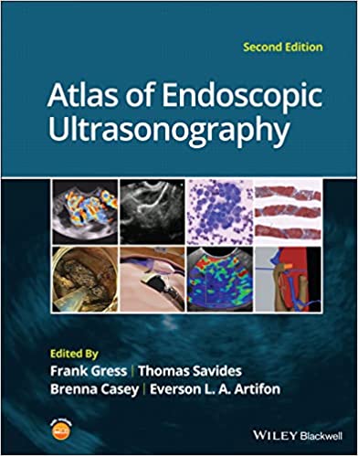 (eBook PDF)Atlas of Endoscopic Ultrasonography 2nd Edition by Frank G. Gress , Thomas J. Savides , Brenna Casey , Everson L. A. Artifon 