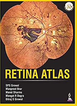 (eBook PDF)Retina Atlas  by Manpreet Grewal,SPS: Brar,Mansi Sharm,Mangat Ram Dogra,Dilraj S Grewal