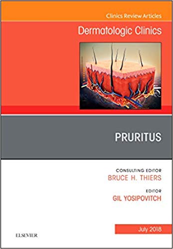 (eBook PDF)Pruritus Dermatologic Clinics by Gil Yosipovitch MD 