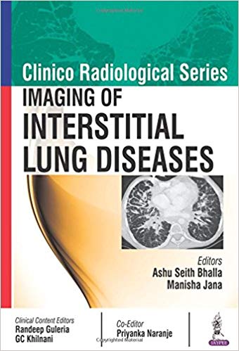 (eBook PDF)Imaging of Interstitial Lung Diseases by Manisha Jana 