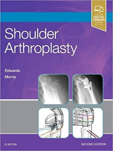 (eBook PDF)Shoulder Arthroplasty, 2e 2nd Edition by T. Bradley Edwards MD , Brent J. Morris MD 
