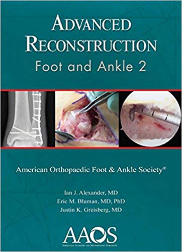 (eBook PDF)Advanced Reconstruction - Foot and Ankle 2 by Ian J. Alexander MD 