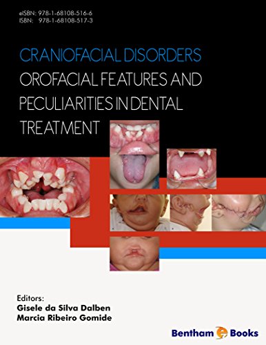 (eBook PDF)Craniofacial Disorders - Orofacial Features and Peculiarities in Dental Treatment by Gisele da Silva Dalben 