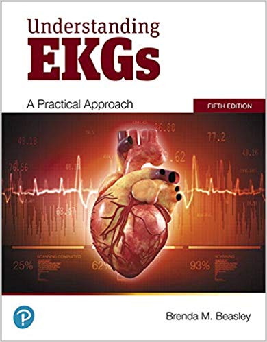 (eBook PDF)Understanding EKGs A Pratical Approach, 5th Edition  by Brenda M. Beasley 