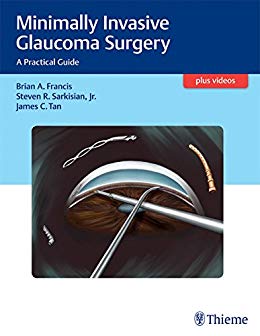(eBook PDF)Minimally Invasive Glaucoma Surgery: A Practical Guide + Videos by Brian Francis , Steven Sarkisian , James C. Tan 