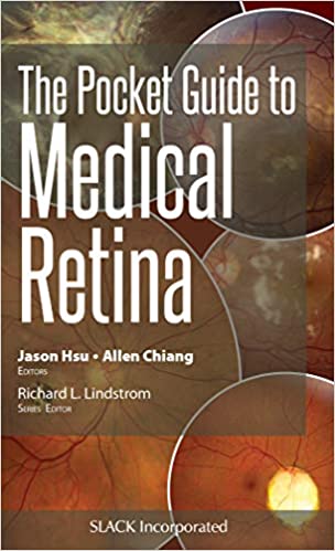 (eBook PDF)The Pocket Guide to Medical Retina by Jason Hsu 