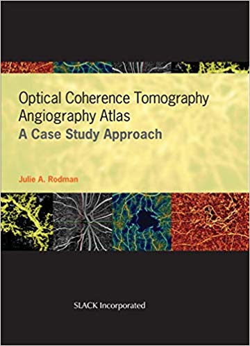 (eBook PDF)Optical Coherence Tomography Angiography Atlas by Julie A Rodman OD MSc FAAO , Dan Esmaili MD (Foreword)