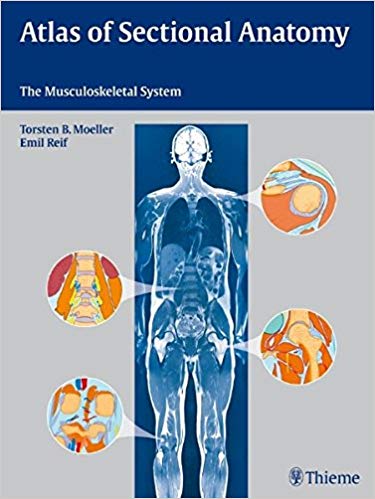 (eBook PDF)Atlas of Sectional Anatomy - The Musculoskeletal System by Torsten Bert Moeller , Torsten Bert Möller , Emil Reif 