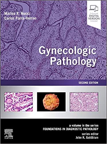 (eBook PDF)Gynecologic Pathology: A Volume in Foundations in Diagnostic Pathology Series 2nd Edition by Marisa R. Nucci MD , Carlos Parra-Herran 